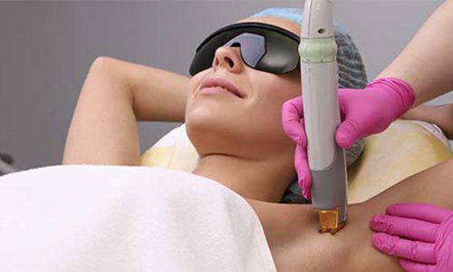 Laser Hair Removal